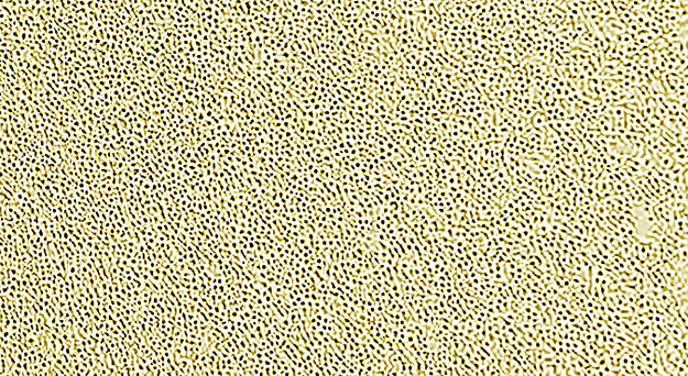 refractory